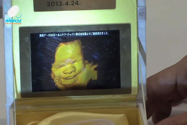هولوگرام سه بعدی از نوزاد درون رحم